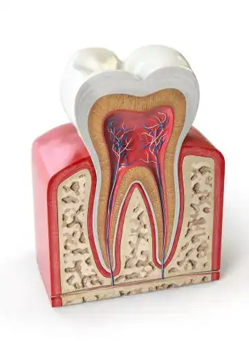 diente dentista salud dental – SoyMigrante.com REVISTA Molde de diente con estructura interna, raíces y pulpa, mostrando anatomía odontológica para ilustrar temas de salud oral y odontología. – SoyMigrante.com REVISTA
