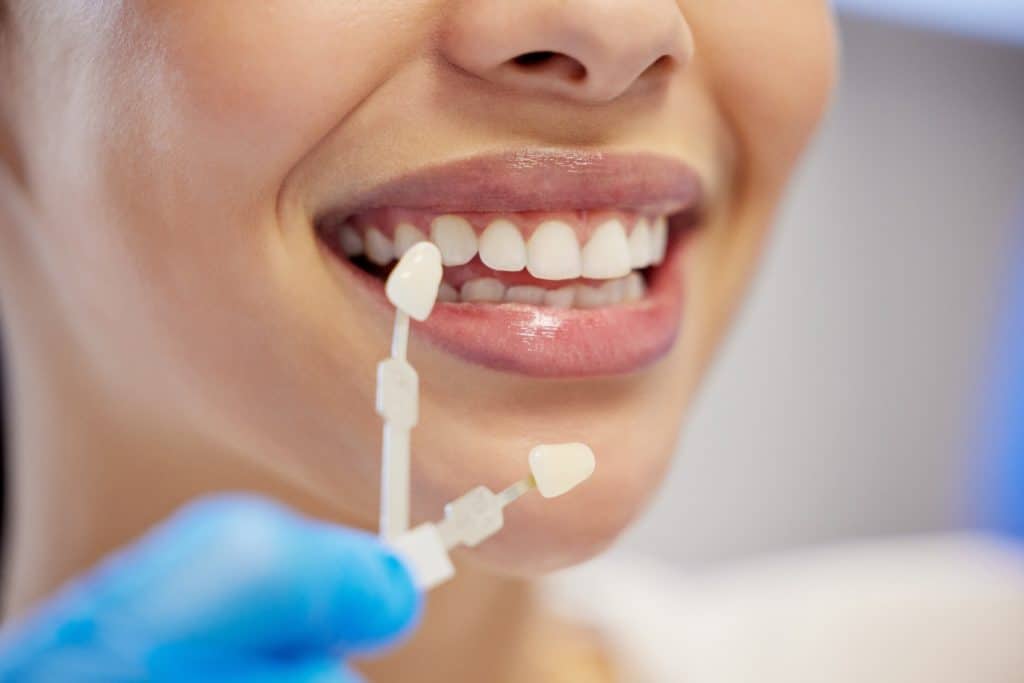 Blanqueamiento dental profesional, sonrisa saludable, cuidado bucal, tratamiento dental, estética dental, salud oral, blanqueamiento en clínica dental. – SoyMigrante.com REVISTA