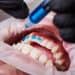 Técnico realizando tratamiento de fluoración dental en joven paciente, enfoque en salud bucal y prevención de caries, en consulta odontológica moderna.