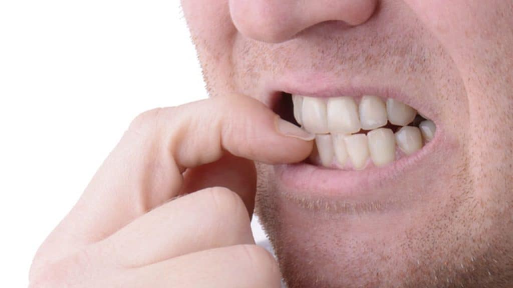 Morderse las uñas podría causarle enfermedades a la mano. (Foto: Envato) – SoyMigrante.com REVISTA