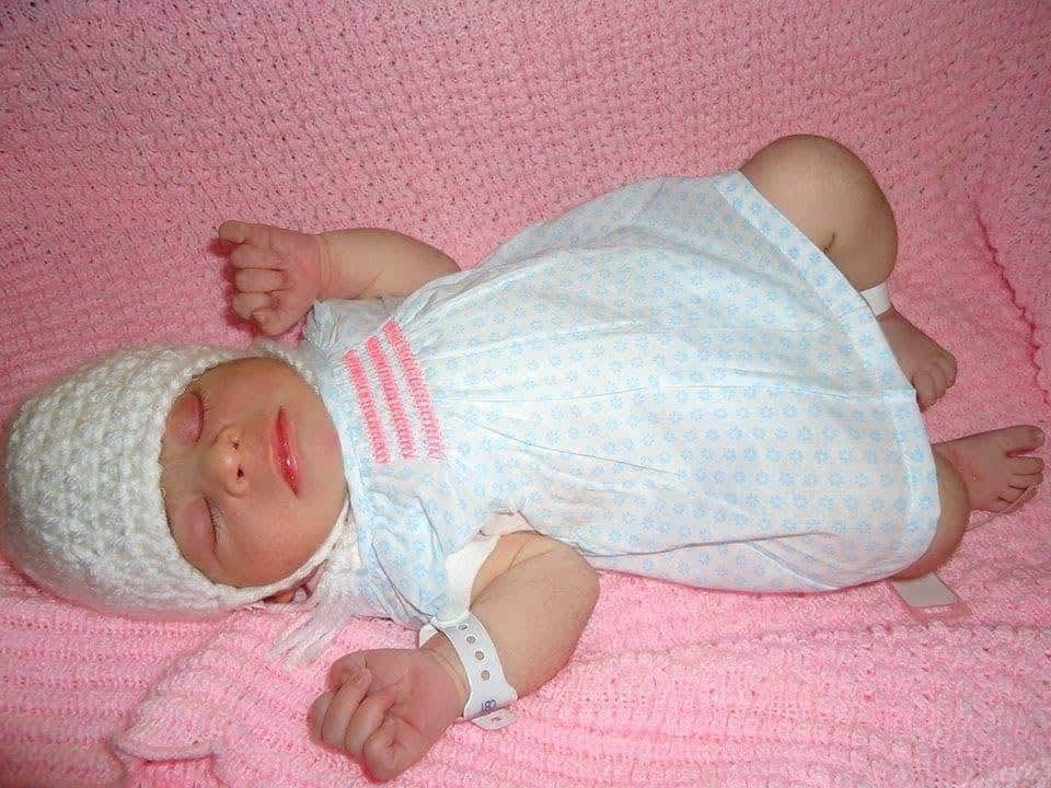 La valentía y ganas de vivir de Angela siguen inspirando a Sonia, a su familia y a todas las personas con las cuales comparte su testimonio. Crearon una fundación de apoyo a padres que enfrentan diagnósticos difíciles durante el embarazo y es así como Angela ha apoyado a personas en decenas de países, a la vez que predica el amor a la vida y el derecho a vivir de todo bebé. (Angela a los pocos días de la intervención quirúrgica con la cual cerraron su cráneo)