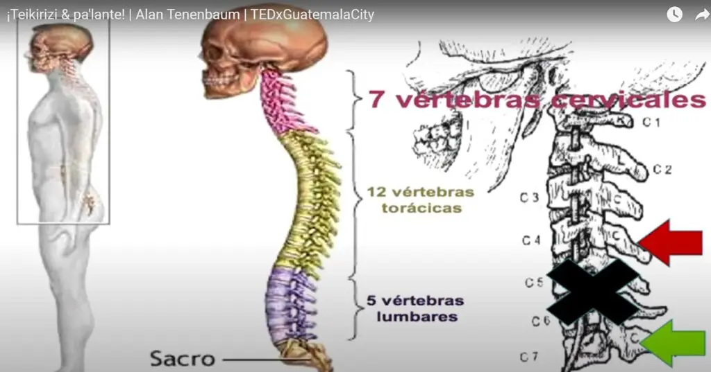 Diapositiva presentada por Alan Tenembaum en esta conferencia de TedX para mostrar donde ocurrió su lesión. La flecha verde representaría un mejor escenario de movilidad y la flecha roja una situación mucho peor. Entre ambas solo hay pocos milímetros de diferencia. – SoyMigrante.com – SoyMigrante.com